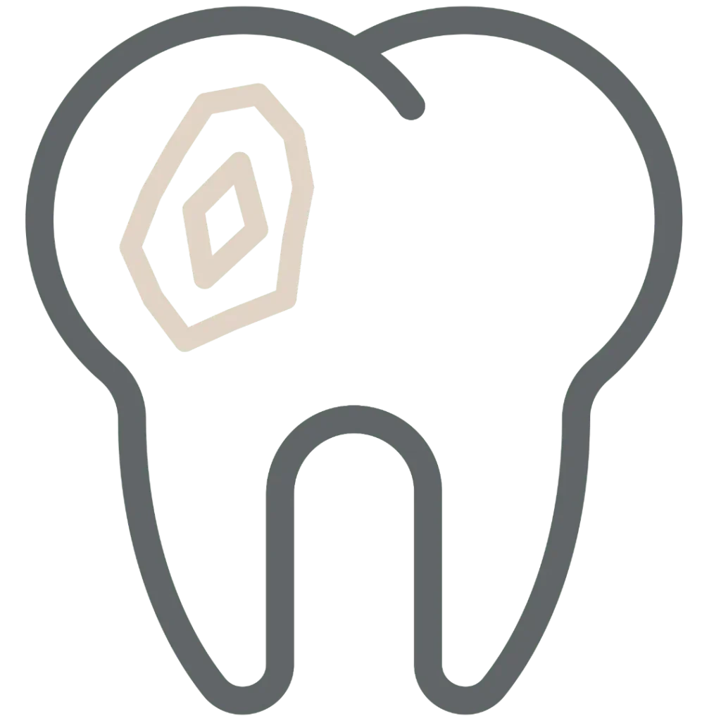 Otturazioni a Raffadali Agrigento