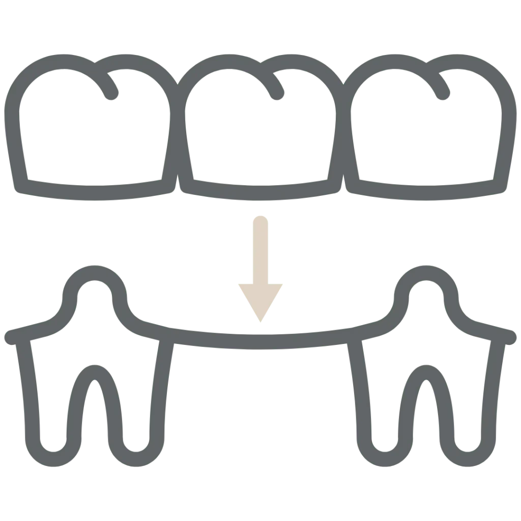 protesi fissa e dentiera a Raffadali Agrigento